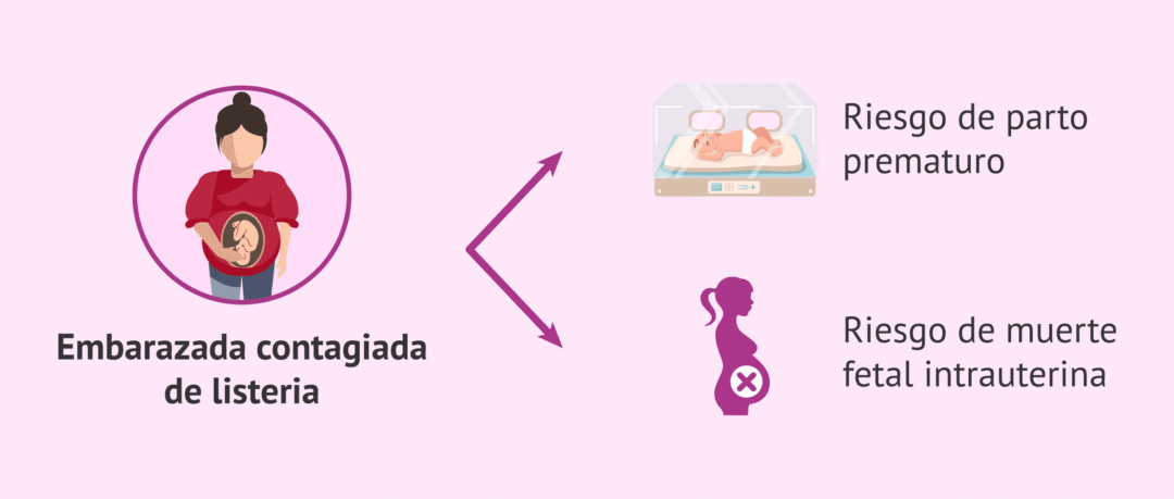 Listeriosis: Lo que hay que saber sobre esta enfermedad transmitida por quesos criollos