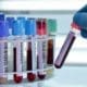 La provincia empadrona a bioquímicos para trabajar en el departamento General López