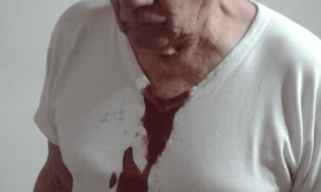 Santa Isabel: Mario Kovacevich ex presidente comunal fue golpeado por la policia