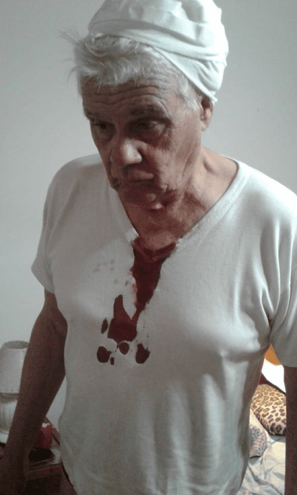 Santa Isabel: Mario Kovacevich ex presidente comunal fue golpeado por la policia