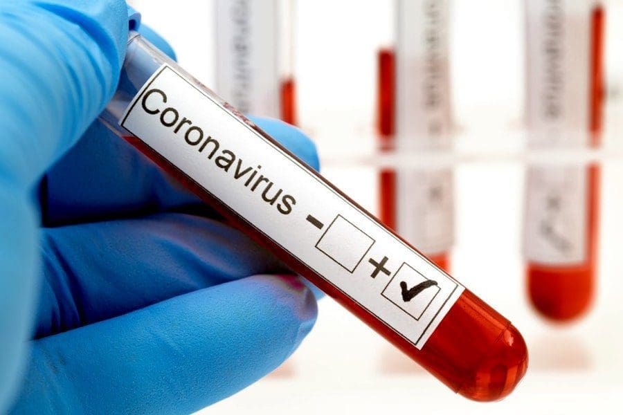 Villa Cañás: Confirman 4 nuevos casos positivos de Coronavirus
