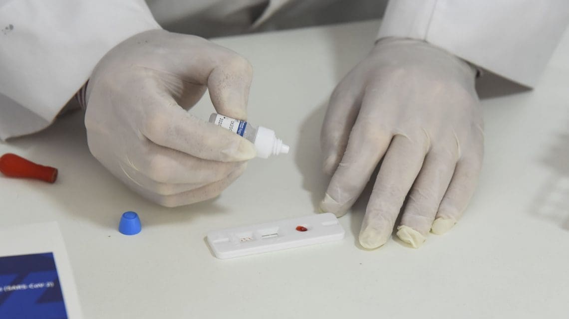 COVID-19: La provincia adhirió al procedimiento para el reporte del uso y la notificación del resultado de los autotest
