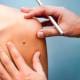 Argentina será el primer país en usar una vacuna contra el cáncer de piel más agresivo