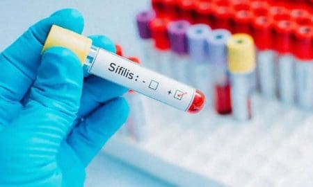 Sexo inseguro: Impactante suba de casos de sífilis en la provincia de Santa Fe